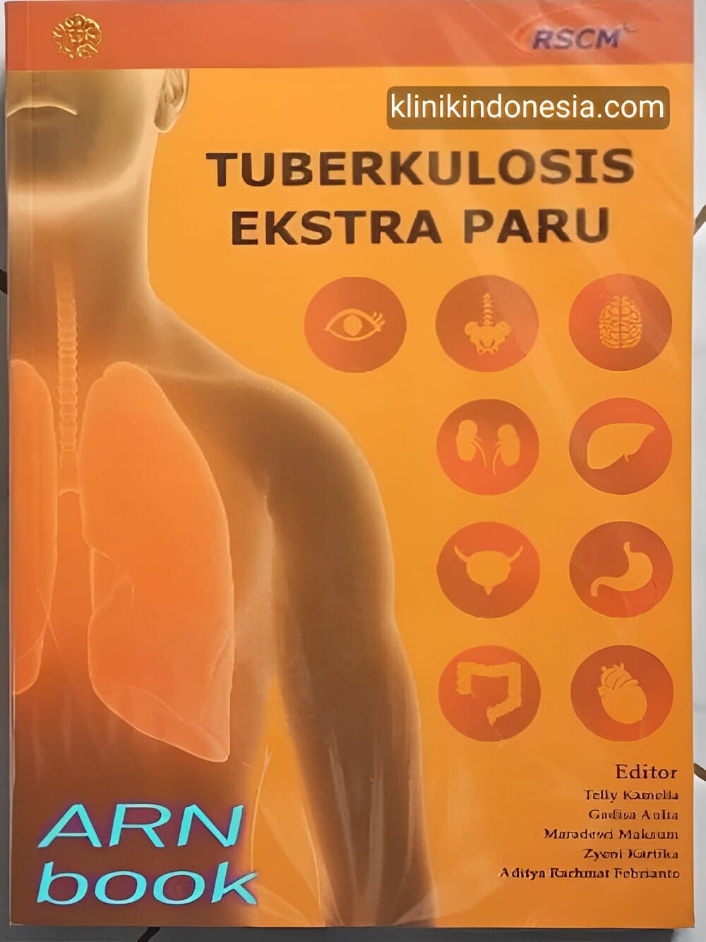 Gambar Buku Ajar Tuberkulosis Ekstra Paru