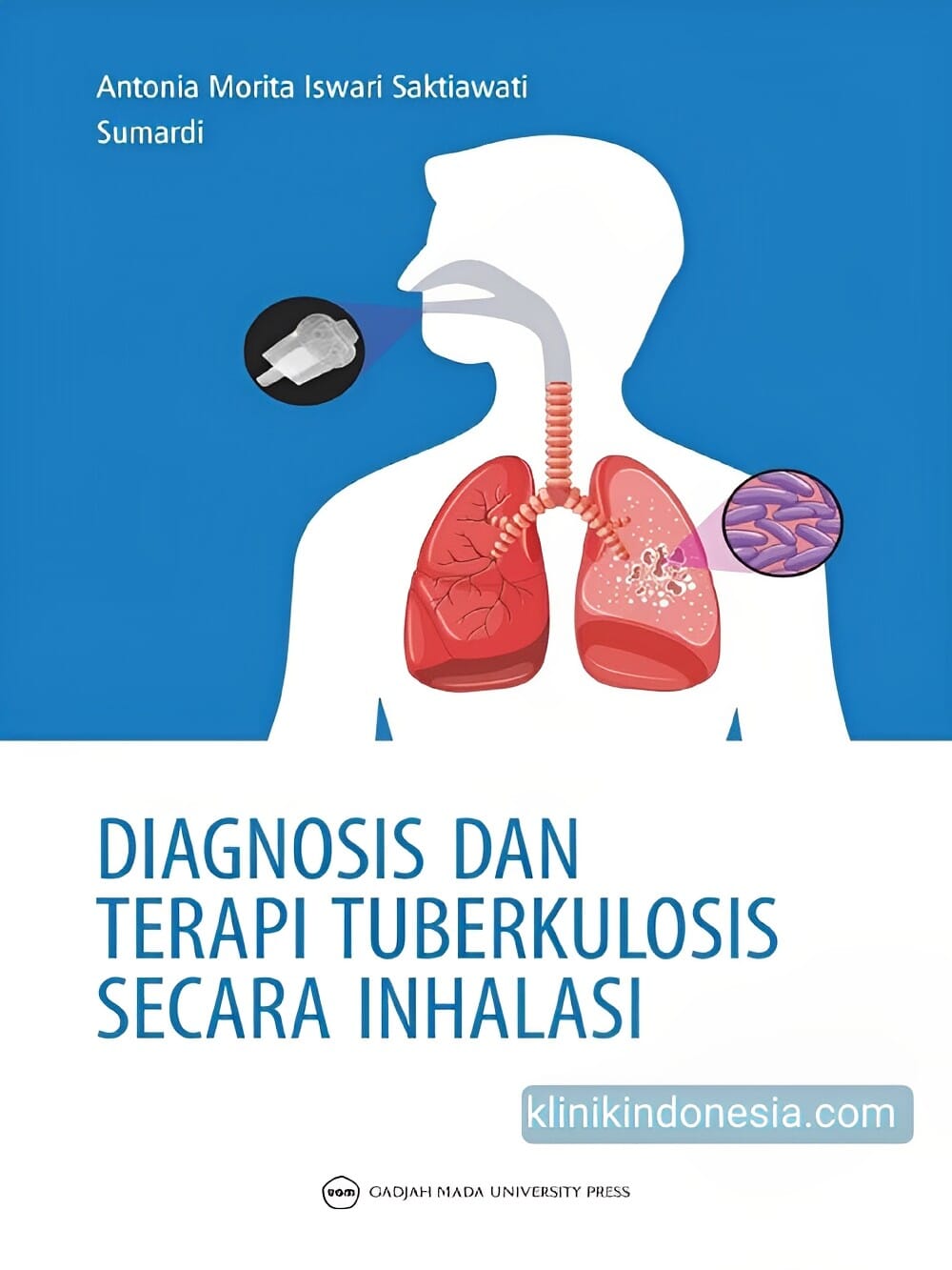 Gambar Diagnosis dan Terapi Tuberkulosis Secara Inhalasi