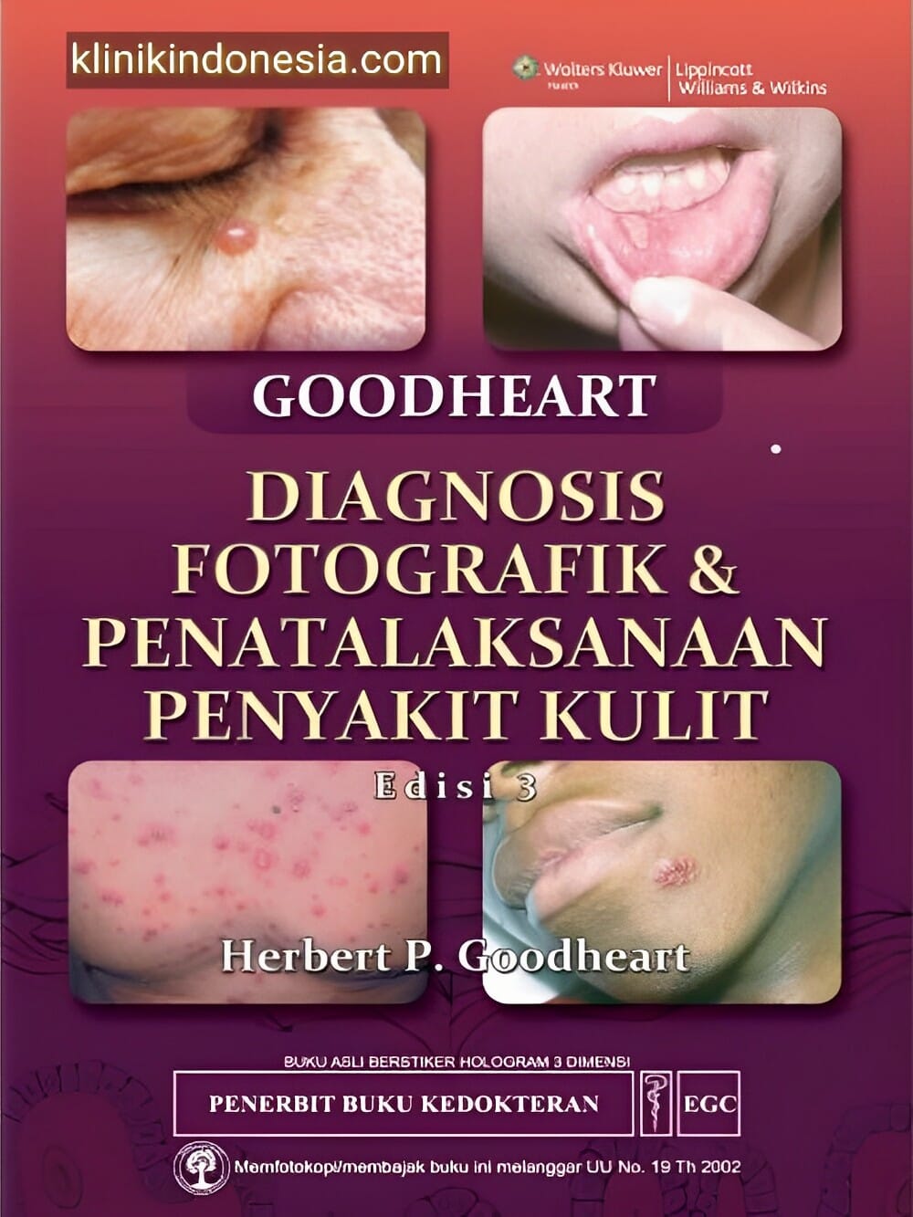 Gambar Diagnosis Fotografik & Penatalaksanaan Penyakit Kulit