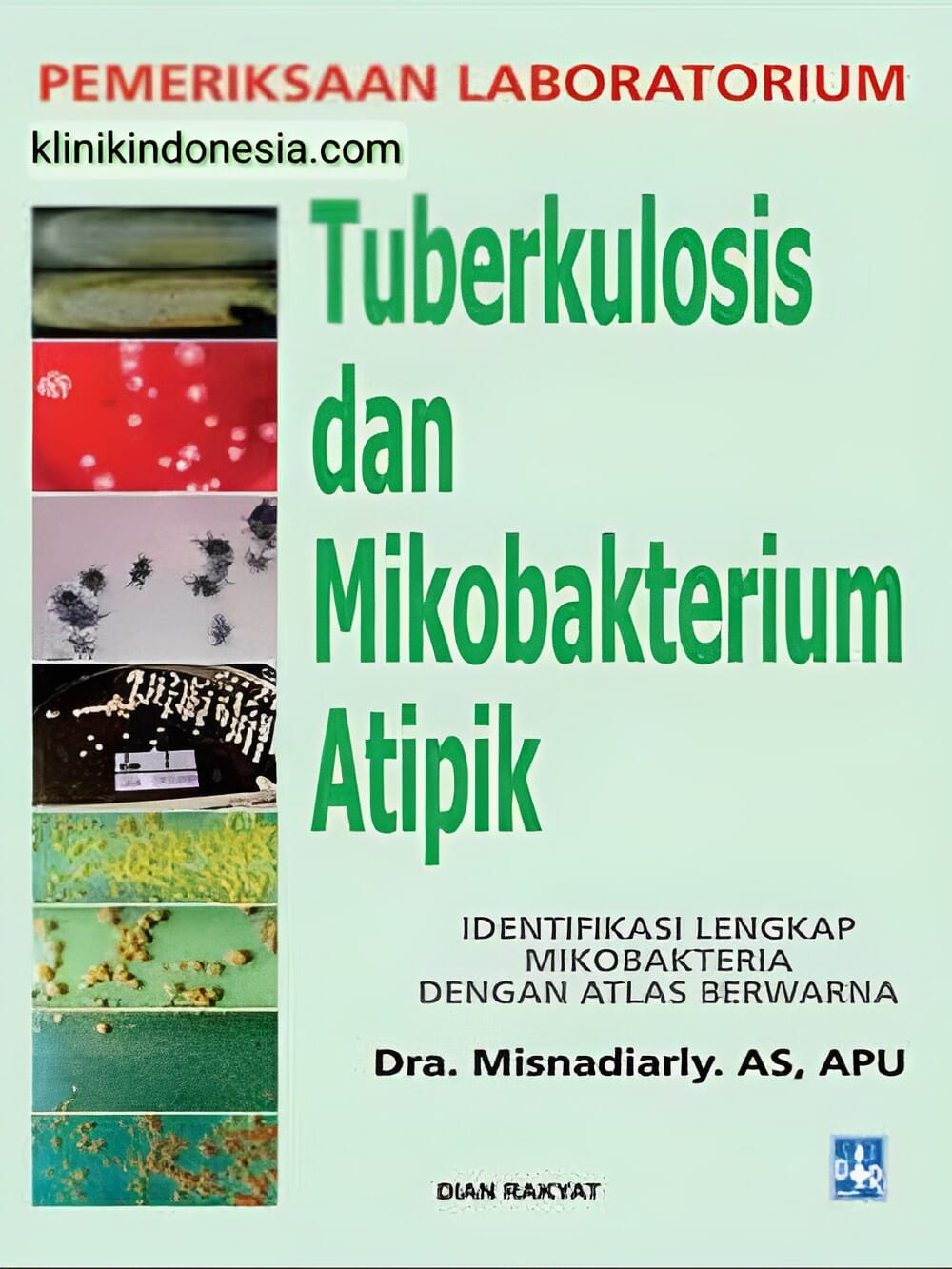 Gambar Pemeriksaan Laboratorium Tuberkulosis dan Mikobakterium Atipik
