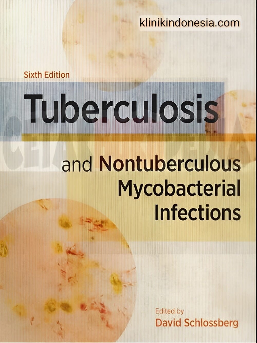 Gambar Tuberculosis and Nontuberculous Mycobacterial Infections