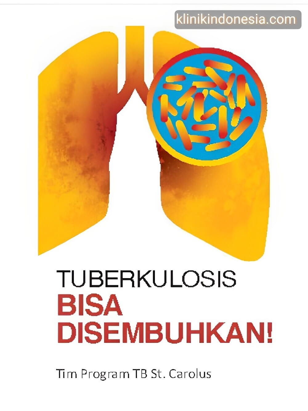 Gambar Tuberkulosis Bisa Disembuhkan